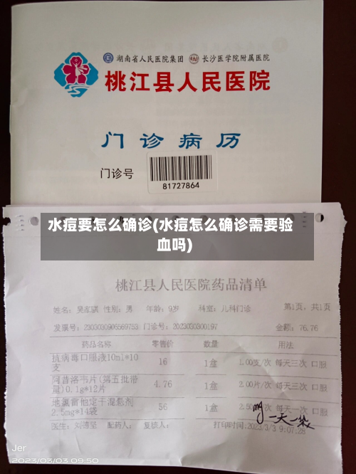 水痘要怎么确诊(水痘怎么确诊需要验血吗)