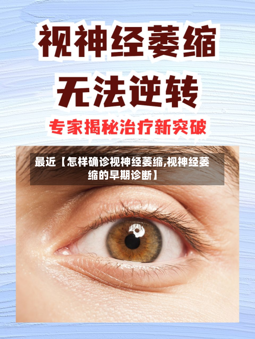 最近【怎样确诊视神经萎缩,视神经萎缩的早期诊断】