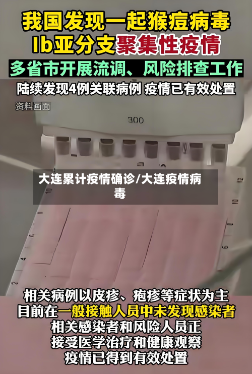 大连累计疫情确诊/大连疫情病毒