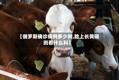 【俄罗斯确诊病例多少例,脸上长黄褐斑看什么科】